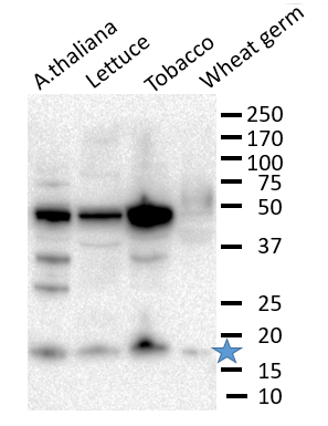 Western blot using anti-eIF1 antibodies